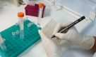 Zika: pesquisa de SP associa baixa atividade de enzima a microcefalia