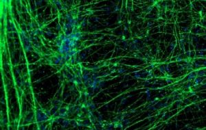 Unicamp: Estudo aponta que novo coronavírus é capaz de infectar neurônios humanos