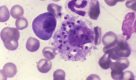 Leishmaniose visceral: estudo de SP desenvolve teste para nova espécie de parasita