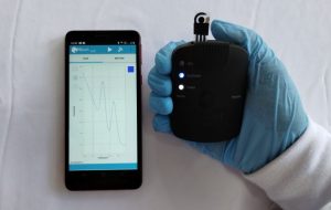 Sensor permite teste de urina para detectar doenças como câncer, gota e Parkinson